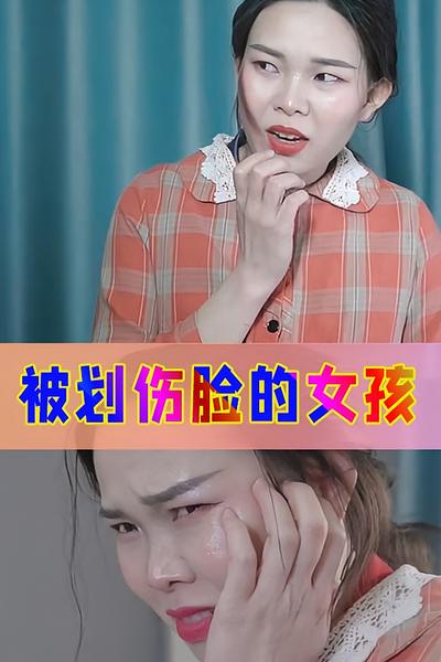 被划伤脸的女孩封面图